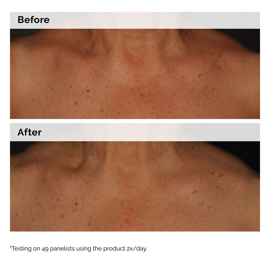 The Ordinary Niacinamide 5% Face and Body Emulsion