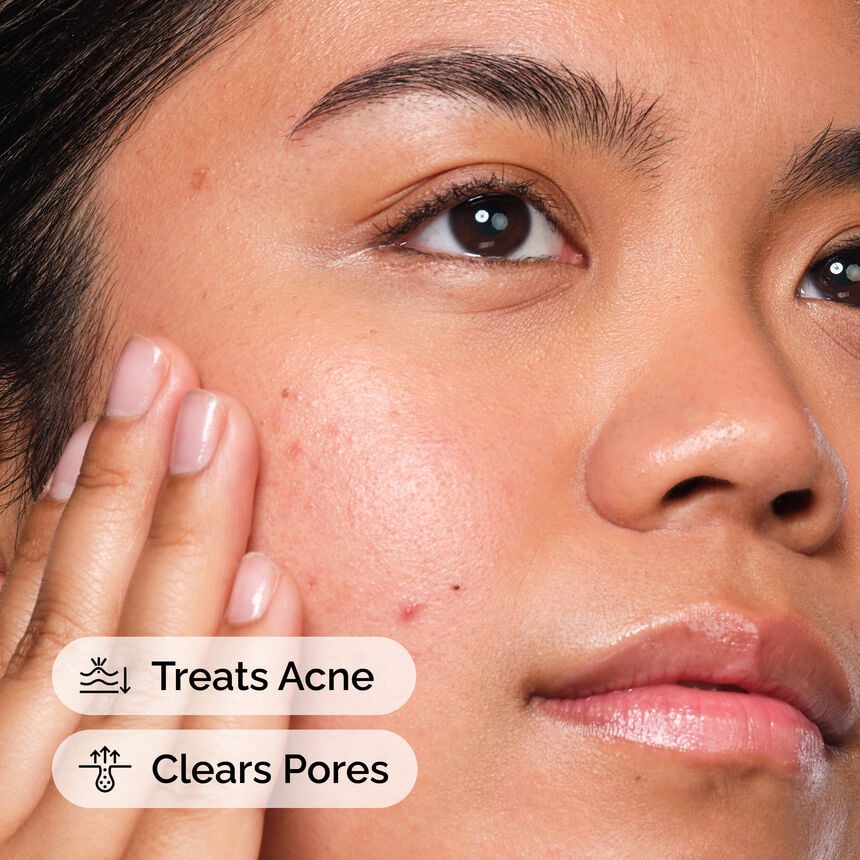 The Ordinary Salicylic Acid 2% Solution