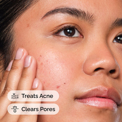 The Ordinary Salicylic Acid 2% Solution