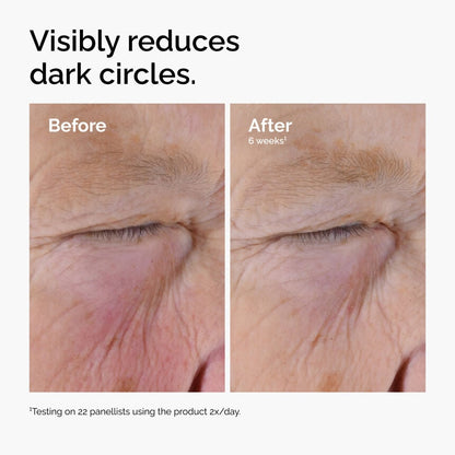 The Ordinary Caffeine Solution 5% + EGCG Eye Serum